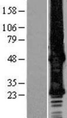 Western Blot: Connexin 30/GJB6 Overexpression Lysate [NBP2-04320]