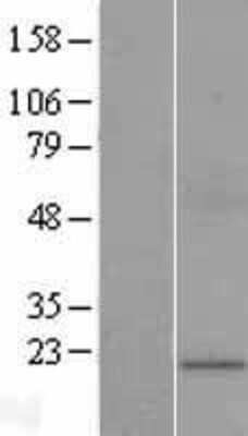 Western Blot: Connexin 25/GJB7 Overexpression Lysate [NBL1-11099]