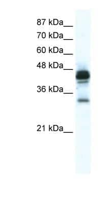 Western Blot: GJC3 Antibody [NBP1-59162]