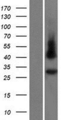 Western Blot: GJC3 Overexpression Lysate [NBP2-04911]