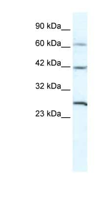 Western Blot: GJD3 Antibody [NBP1-59160]