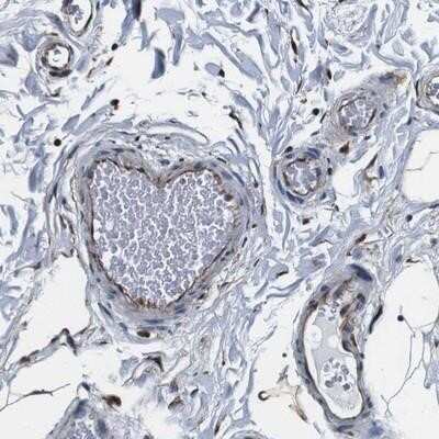 Immunohistochemistry-Paraffin: GJE1 Antibody [NBP2-14051]