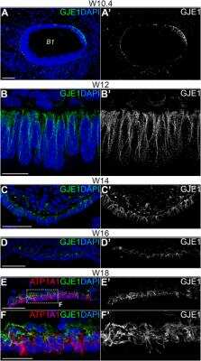 Immunohistochemistry-Paraffin: GJE1 Antibody [NBP2-14051]