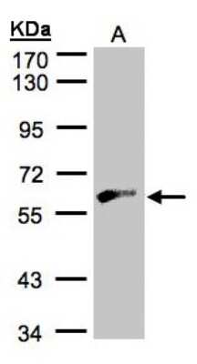 Western Blot: GK2 Antibody [NBP1-32210]