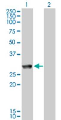 Western Blot: GK5 Antibody (2C11) [H00256356-M11]