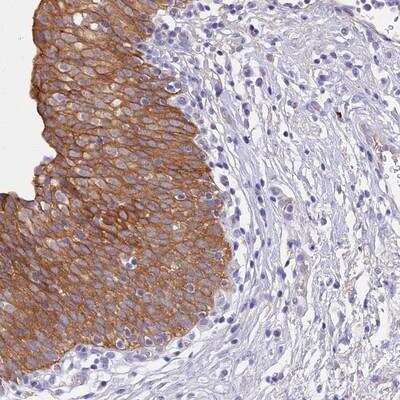 Immunohistochemistry-Paraffin: GK5 Antibody [NBP1-82692]