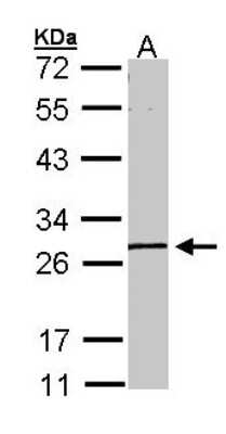 Western Blot: GK5 Antibody [NBP1-32863]