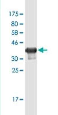 Western Blot: GKAP/DLGAP1 Antibody (2A6) [H00009229-M02-100ug]