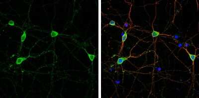 Immunocytochemistry/ Immunofluorescence: GKAP/DLGAP1 Antibody [NBP3-13181]
