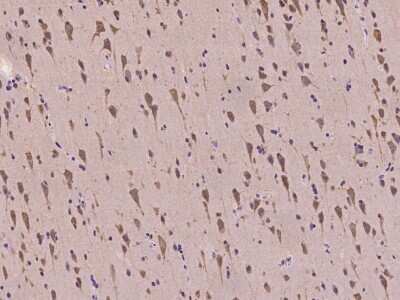 Immunohistochemistry-Paraffin: GKAP/DLGAP1 Antibody [NBP2-98138]