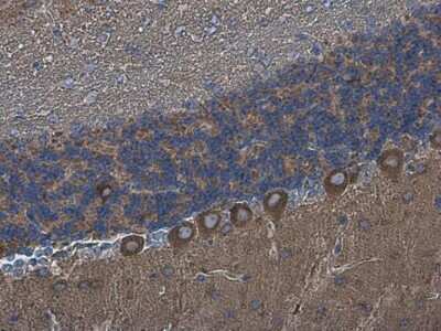 Immunohistochemistry-Paraffin: GKAP/DLGAP1 Antibody [NBP3-13181]