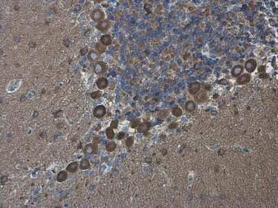 Immunohistochemistry-Paraffin: GKAP/DLGAP1 Antibody [NBP3-13181]