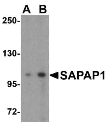 Western Blot: GKAP/DLGAP1 AntibodyBSA Free [NBP1-76911]