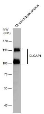 Western Blot: GKAP/DLGAP1 Antibody [NBP3-13181]