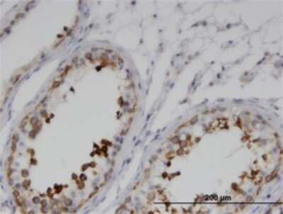 Immunohistochemistry-Paraffin: GKAP1 Antibody (1B9) [H00080318-M01]