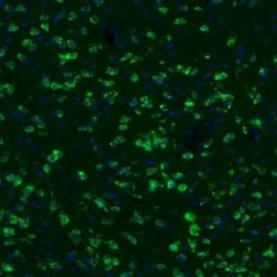 Immunohistochemistry: GKAP1 Antibody [NBP2-33989]
