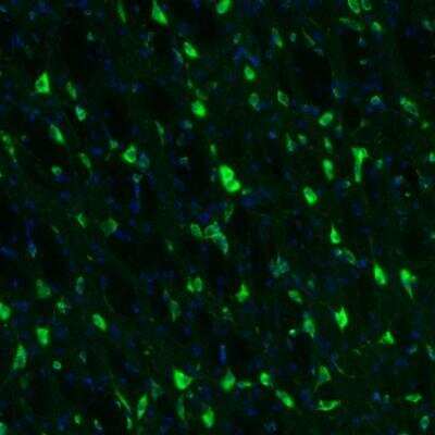 Immunohistochemistry: GKAP1 Antibody [NBP2-33989]