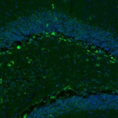 Immunohistochemistry: GKAP1 Antibody [NBP2-33989]