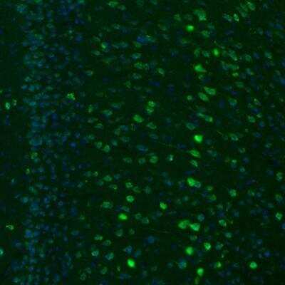 Immunohistochemistry: GKAP1 Antibody [NBP2-33989]