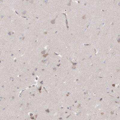 Immunohistochemistry: GKAP1 Antibody [NBP2-33989]