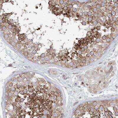 Immunohistochemistry: GKAP1 Antibody [NBP2-33989]