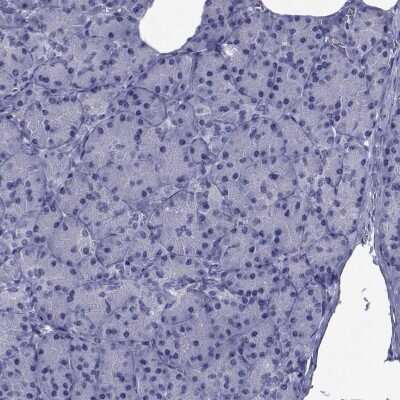 Immunohistochemistry-Paraffin: GKAP1 Antibody [NBP1-84669]