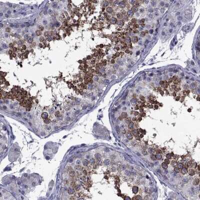 Immunohistochemistry-Paraffin: GKAP1 Antibody [NBP1-84669]