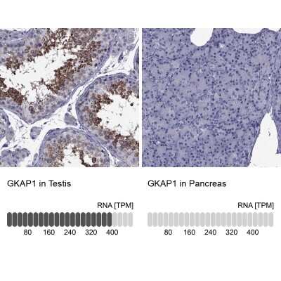 Immunohistochemistry-Paraffin: GKAP1 Antibody [NBP1-84669]