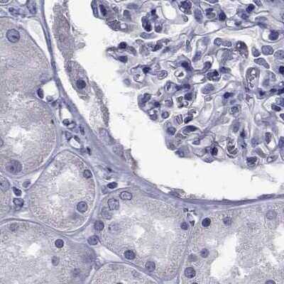 Immunohistochemistry-Paraffin: GKAP1 Antibody [NBP1-84669]