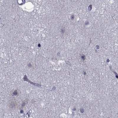 Immunohistochemistry-Paraffin: GKAP1 Antibody [NBP1-84669]
