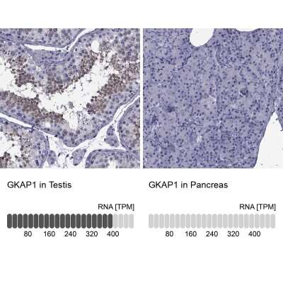 Immunohistochemistry-Paraffin: GKAP1 Antibody [NBP2-62650]