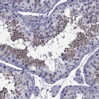 Immunohistochemistry-Paraffin: GKAP1 Antibody [NBP2-62650]