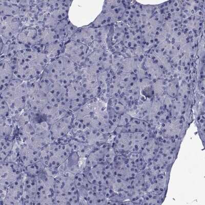 Immunohistochemistry-Paraffin: GKAP1 Antibody [NBP2-62650]