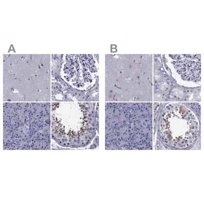 Immunohistochemistry-Paraffin: GKAP1 Antibody [NBP2-62650]