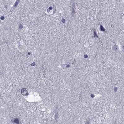 Immunohistochemistry-Paraffin: GKAP1 Antibody [NBP2-62650]