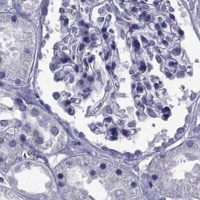 Immunohistochemistry-Paraffin: GKAP1 Antibody [NBP2-62650]