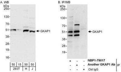 Western Blot: GKAP1 Antibody [NBP1-79017]