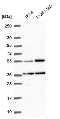 Western Blot: GKAP1 Antibody [NBP2-62650]