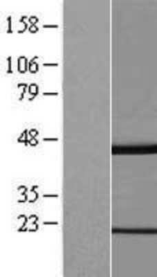 Western Blot: GKAP1 Overexpression Lysate [NBL1-11102]