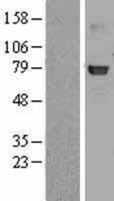 Western Blot: beta-Galactosidase-1/GLB1 Overexpression Lysate [NBL1-11106]