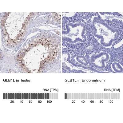 Immunohistochemistry-Paraffin: GLB1L Antibody [NBP1-81235]