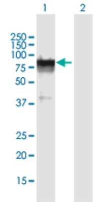 Western Blot: GLB1L Antibody [H00079411-B01P]