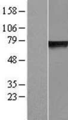 Western Blot: GLB1L Overexpression Lysate [NBP2-06325]