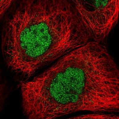 Immunocytochemistry/ Immunofluorescence: GLB1L2 Antibody [NBP2-31585]