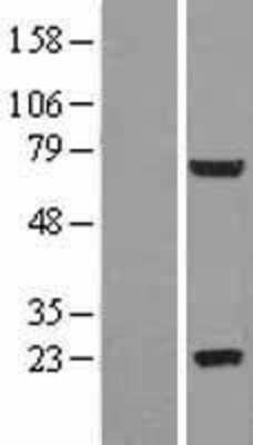 Western Blot: GLB1L2 Overexpression Lysate [NBL1-11107]