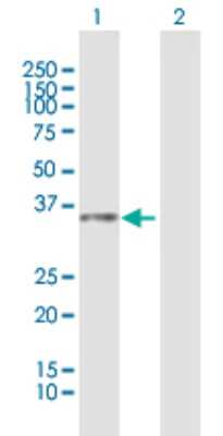 Western Blot: GLB1L3 Antibody [H00112937-B01P]