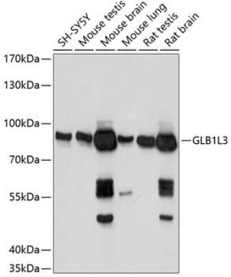 Western Blot: GLB1L3 AntibodyAzide and BSA Free [NBP3-04798]