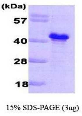 SDS-PAGE: Recombinant Saccharomyces cerevisiae GLC8 His Protein [NBC1-18408]