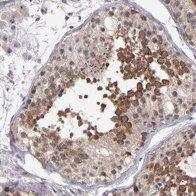 Immunohistochemistry-Paraffin: GLCCl1 Antibody [NBP1-87939]