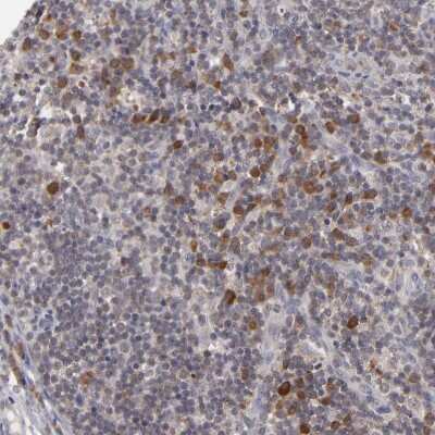 Immunohistochemistry-Paraffin: GLCCl1 Antibody [NBP1-87939]